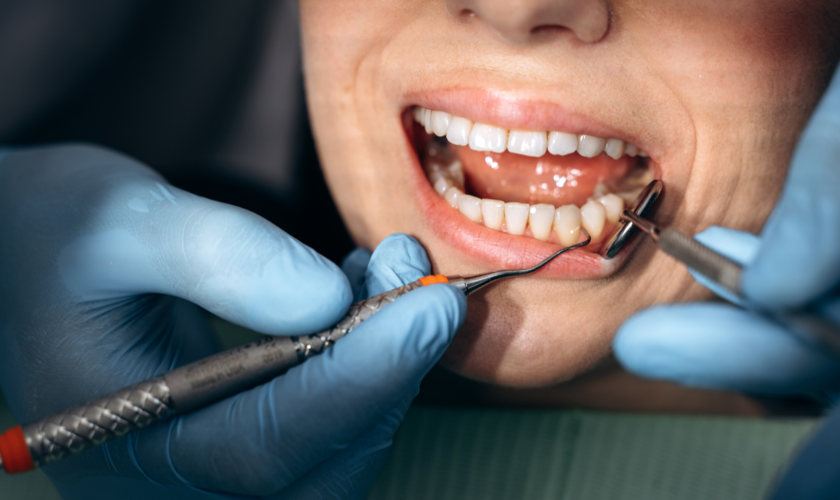 Dental hygienist performing a professional teeth cleaning for a patient in Sparkill NY